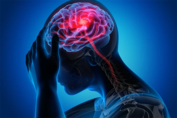 Stroke Act F.A.S.T.